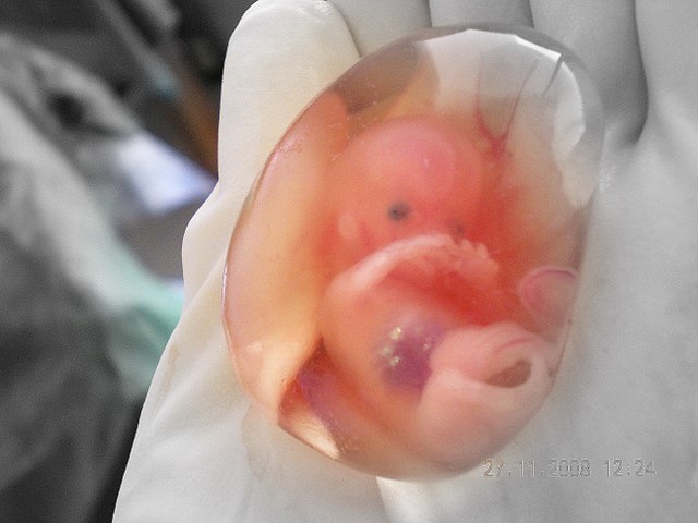 Chính quyền Biden ủng hộ dùng các bộ phận của trẻ sơ sinh bị phá thai để ‘nghiên cứu khoa học’